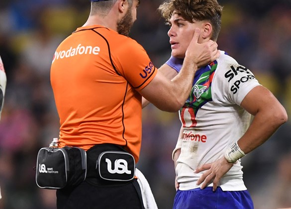 Concussion - Play Rugby League